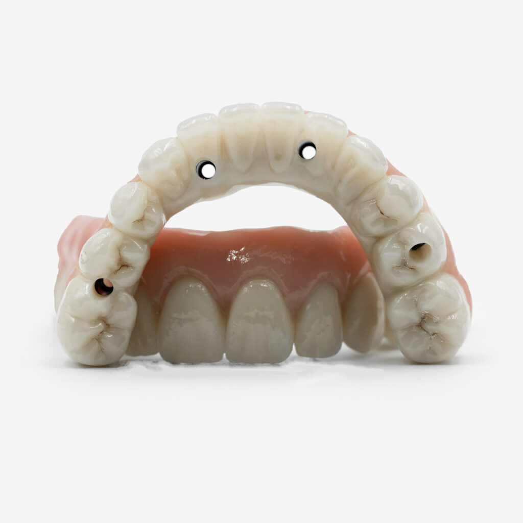 Full arch avvitata diretta con prova Jig inclusa