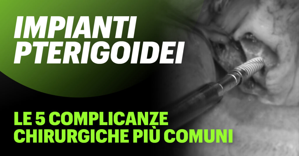 Le 5 complicanze chirurgiche più comuni degli impianti pterigoidei e come prevenirle